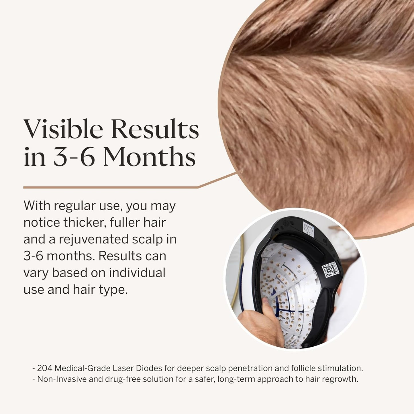 Happy Head Sistema avanzado de crecimiento del cabello con casco láser