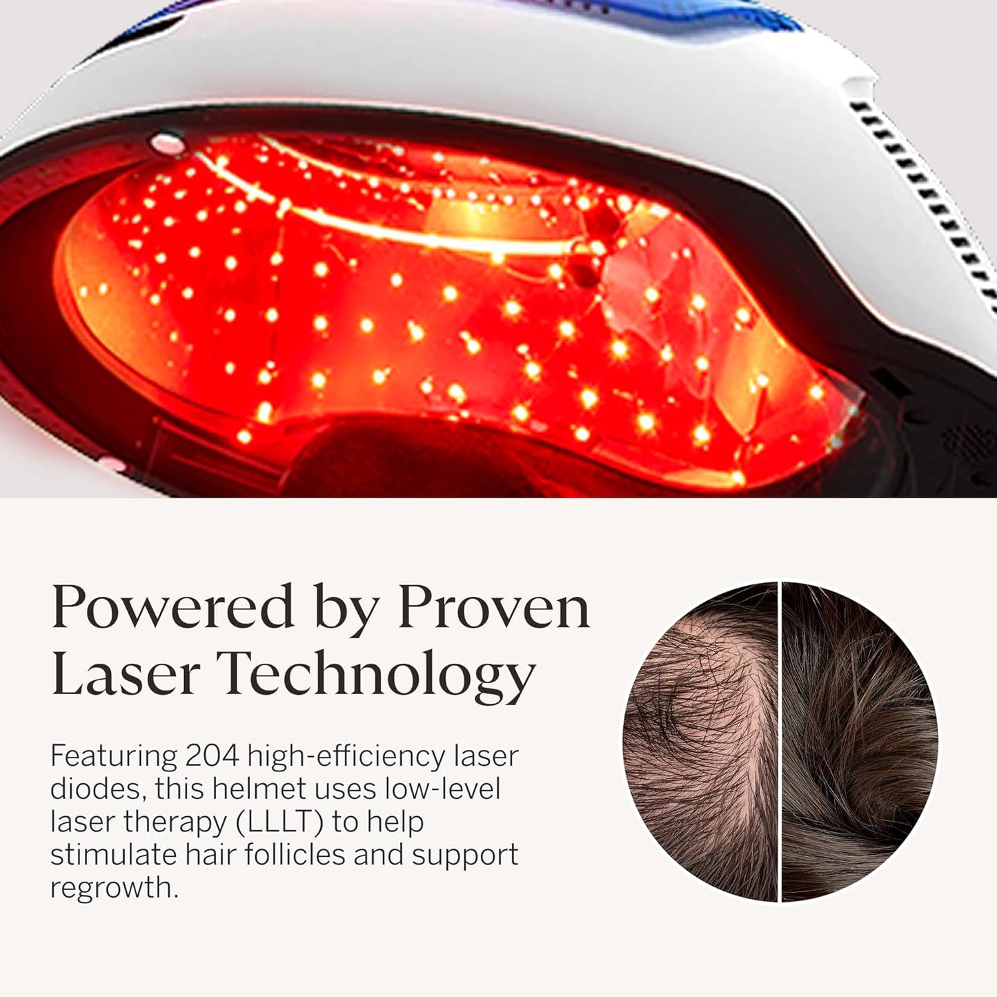 Happy Head Sistema avanzado de crecimiento del cabello con casco láser